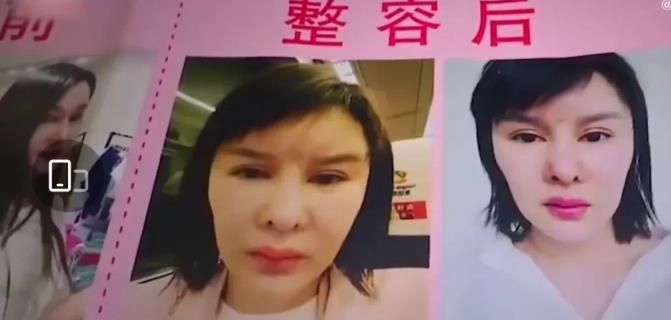 女子花27万做10项整容手术，关于容貌焦虑(图6)